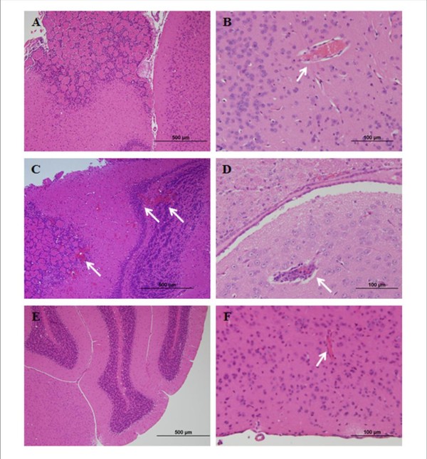 Brain histopathology of non-infected, infected & Artemisone-treated mice